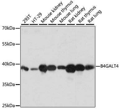 B4GALT4 Rabbit Polyclonal Antibody