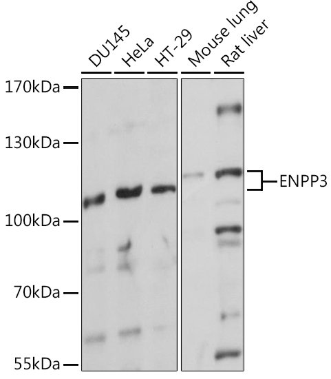 ENPP3 Rabbit Polyclonal Antibody
