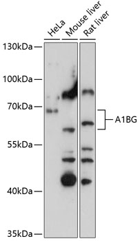 A1BG Rabbit Polyclonal Antibody
