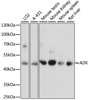 ADK Rabbit Polyclonal Antibody