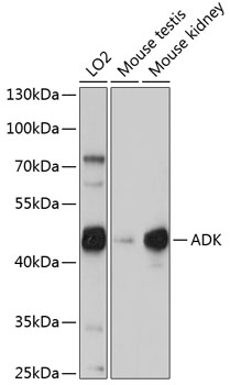 ADK Rabbit Polyclonal Antibody