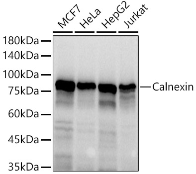 CANX Rabbit Polyclonal Antibody