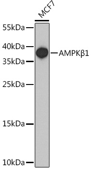PRKAB1 Rabbit Polyclonal Antibody