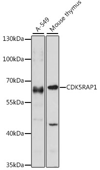 CDK5RAP1 Rabbit Polyclonal Antibody