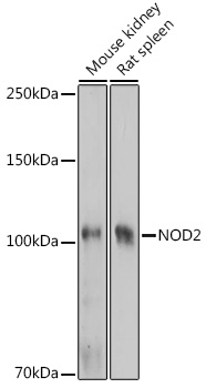 NOD2 Rabbit Polyclonal Antibody