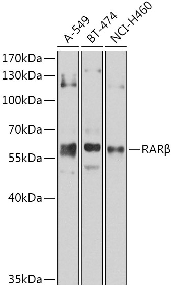 RARB Rabbit Polyclonal Antibody