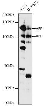 APP Rabbit Polyclonal Antibody
