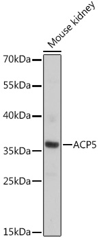 ACP5 Rabbit Polyclonal Antibody