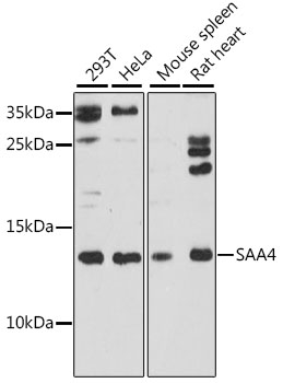 SAA4 Rabbit Polyclonal Antibody