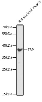 TBP Rabbit Polyclonal Antibody