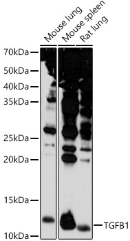 TGFB1 Rabbit Polyclonal Antibody