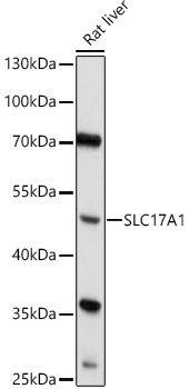 SLC17A1 Rabbit Polyclonal Antibody