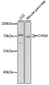 CHGA Rabbit Polyclonal Antibody