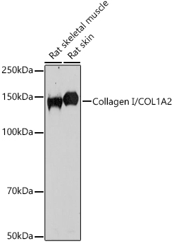 COL1A2 Rabbit Polyclonal Antibody