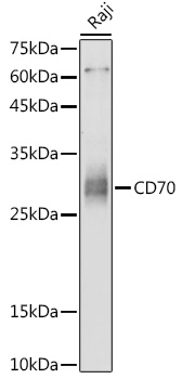 CD70 Rabbit Polyclonal Antibody