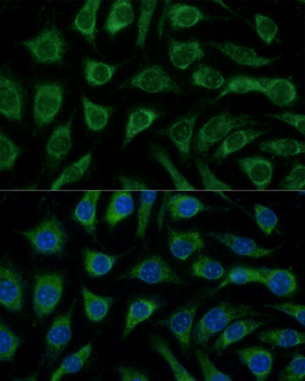 MAPK14 Rabbit Polyclonal Antibody