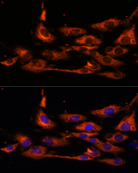 ACOX3 Rabbit Polyclonal Antibody
