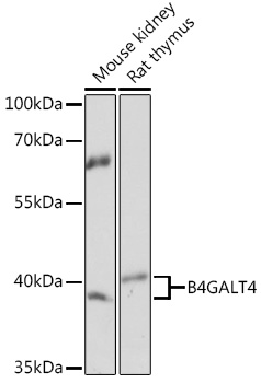 B4GALT4 Rabbit Polyclonal Antibody