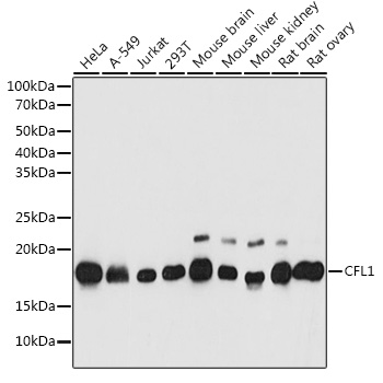 CFL1 Rabbit Polyclonal Antibody