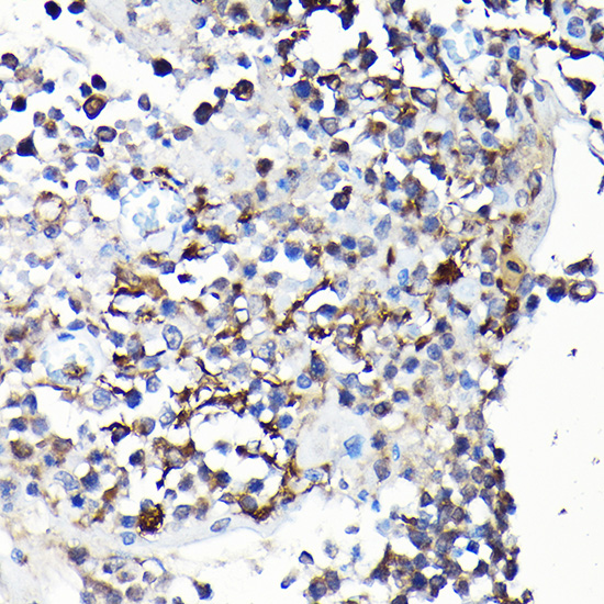 YAP1 Rabbit Polyclonal Antibody