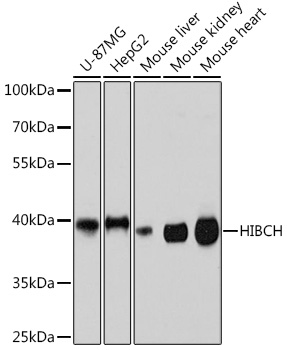 HIBCH Rabbit Polyclonal Antibody