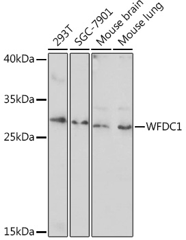 WFDC1 Rabbit Polyclonal Antibody