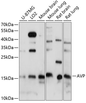 AVP Rabbit Polyclonal Antibody
