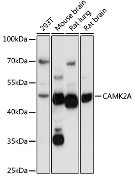CAMK2A Rabbit Polyclonal Antibody