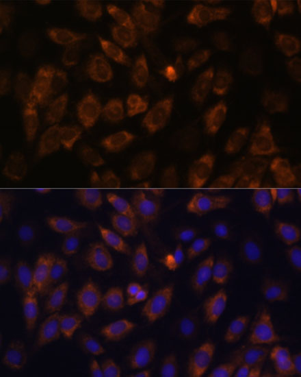 MT-ND4L Rabbit Polyclonal Antibody