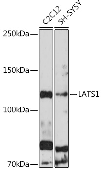 LATS1 Rabbit Polyclonal Antibody