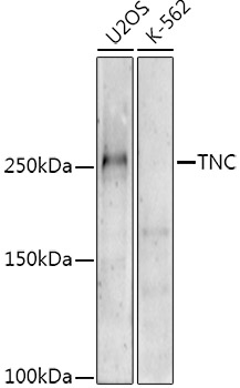 TNC Rabbit Polyclonal Antibody
