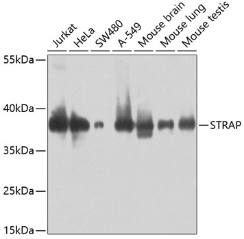 TET3 Rabbit Polyclonal Antibody