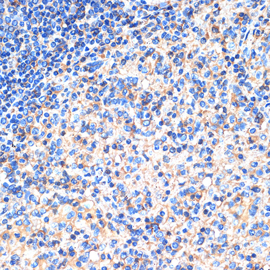SIGLEC15 Rabbit Polyclonal Antibody