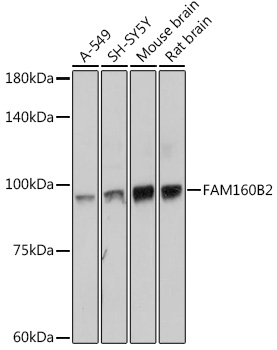 FAM160B2 Rabbit Polyclonal Antibody