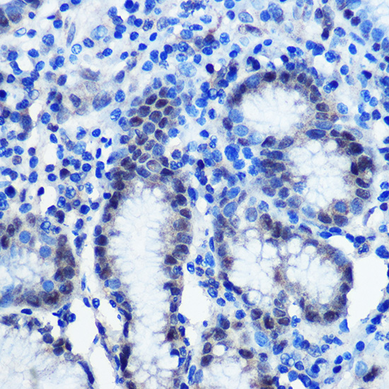 BRD4-S(b) Rabbit Polyclonal Antibody