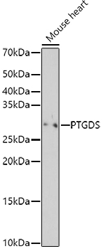PTGDS Rabbit Polyclonal Antibody