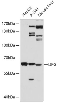 LIPG Rabbit Polyclonal Antibody
