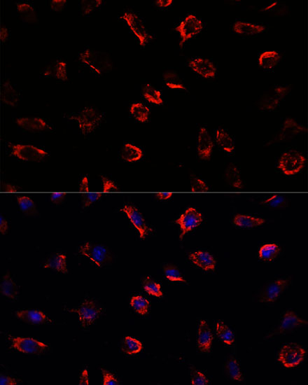 IL11 Rabbit Polyclonal Antibody
