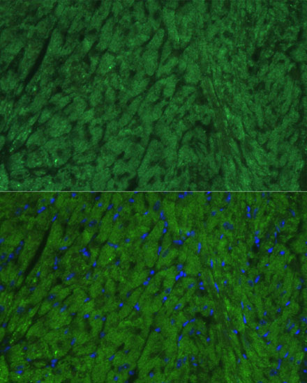 NPPA Rabbit Polyclonal Antibody