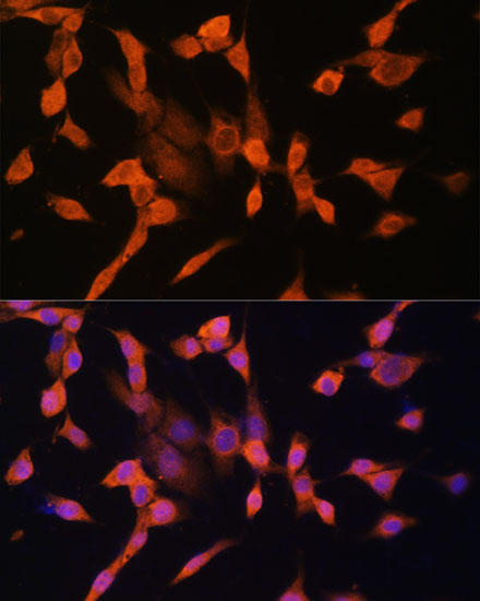 PRKAR1A Rabbit Polyclonal Antibody