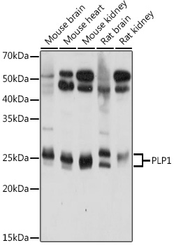 PLP1 Rabbit Polyclonal Antibody