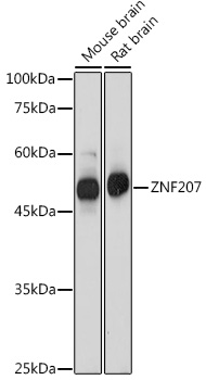 ZNF207 Rabbit Polyclonal Antibody