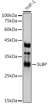 SLBP Rabbit Polyclonal Antibody