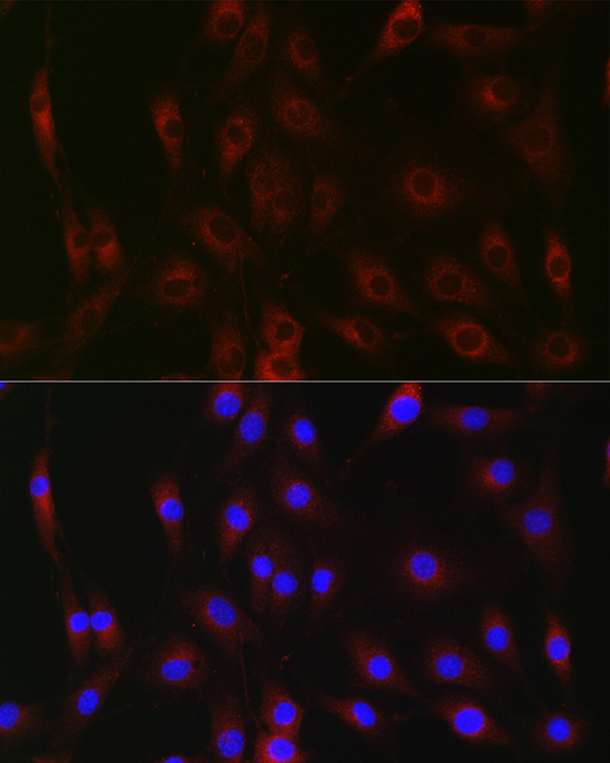 G6PC Rabbit Polyclonal Antibody
