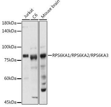 RPS6KA1/RPS6KA2/RPS6KA3 Rabbit Polyclonal Antibody