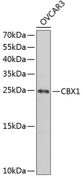 CBX1 Rabbit Polyclonal Antibody
