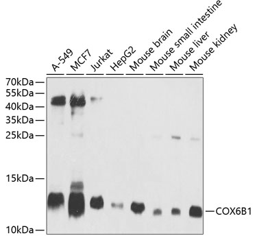 COX6B1 Rabbit Polyclonal Antibody