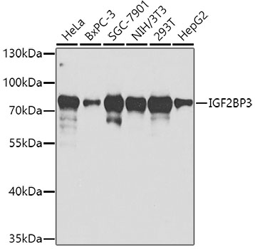 IGF2BP3 Rabbit Polyclonal Antibody