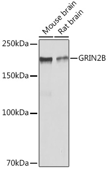 GRIN2B Rabbit Polyclonal Antibody