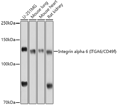 ITGA6 Rabbit Polyclonal Antibody
